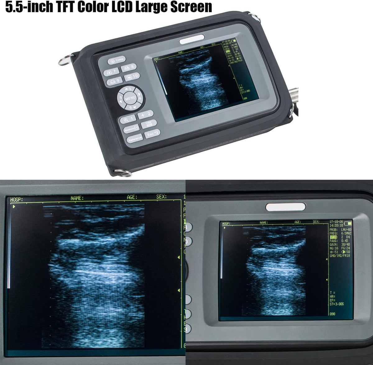 Veterinary Portable Ultrasound Scanner with 4.0MHz Rectal Convex Probe V104896