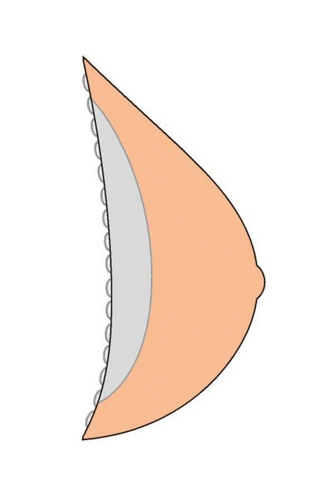 Breast Form H687491